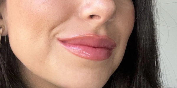 Résultat sur les lèvres de Camille après Repulpeur Lèvres Extrême, effet repulpant immédiat et glossy - Bymee Cosmetics