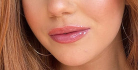 Résultat sur les lèvres d’Éloïse après Repulpeur Lèvres Extrême, effet volume visible et naturel - Bymee Cosmetics