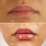 Avant et après repulpeur lèvres effet volume visible bouche ouverte