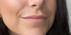 Lèvres de Camille avant application du Repulpeur Lèvres Extrême - Bymee Cosmetics