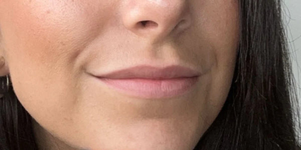 Lèvres de Camille avant application du Repulpeur Lèvres Extrême - Bymee Cosmetics