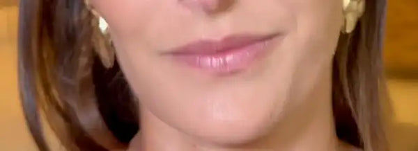 Lèvres de Charlotte avant application du Repulpeur Lèvres Extrême - Bymee Cosmetics