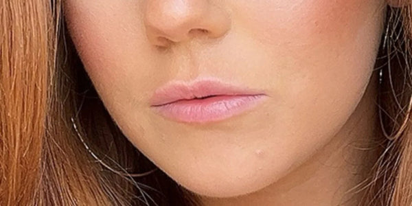 Lèvres d’Éloïse avant application du Repulpeur Lèvres Extrême - Bymee Cosmetics