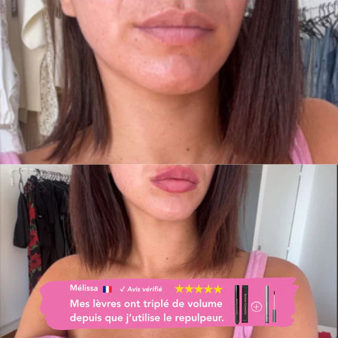 Avant et après Melissa – repulpeur lèvres effet volume immédiat sans injection