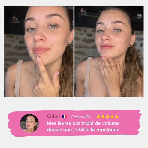Avant et après Chloé – repulpeur lèvres effet volume immédiat sans injection