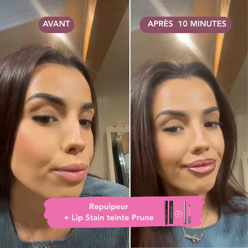 Avant/après teinte prune – repulpeur lèvres effet volume intense sans injection Bymee Cosmetics